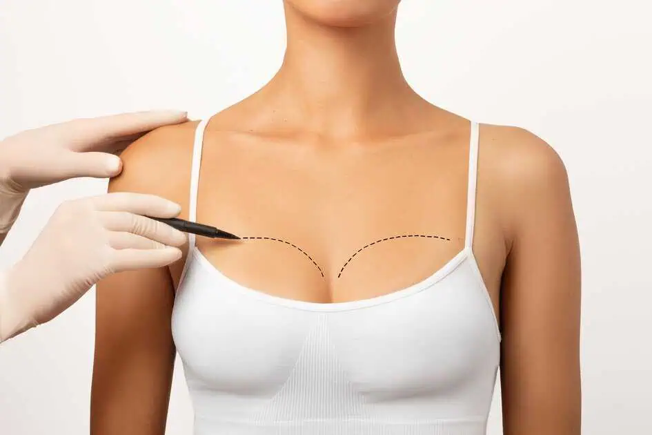 Breast Lift Surgery in Casper, WY by New Beautiful You Inc