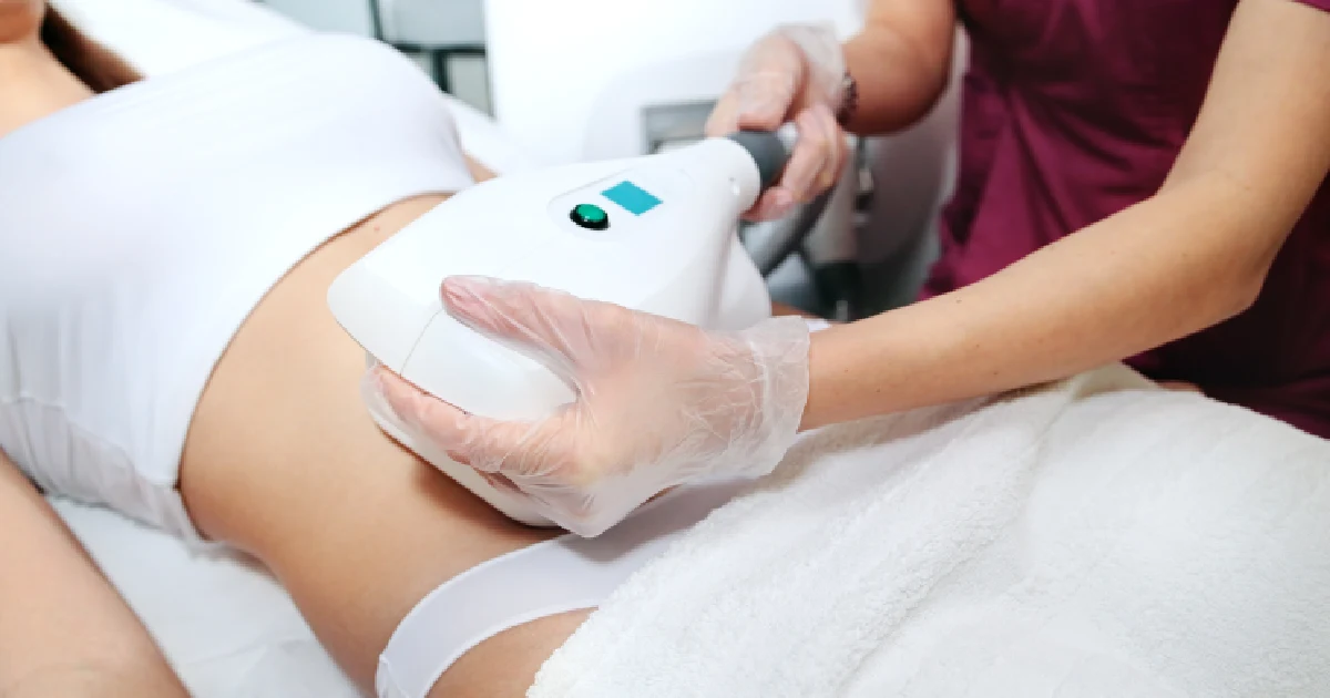 A woman receiving a CoolSculpting treatment in Casper, WY