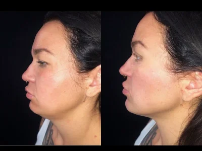 New Beautiful You custom contour ba a in Casper, WY