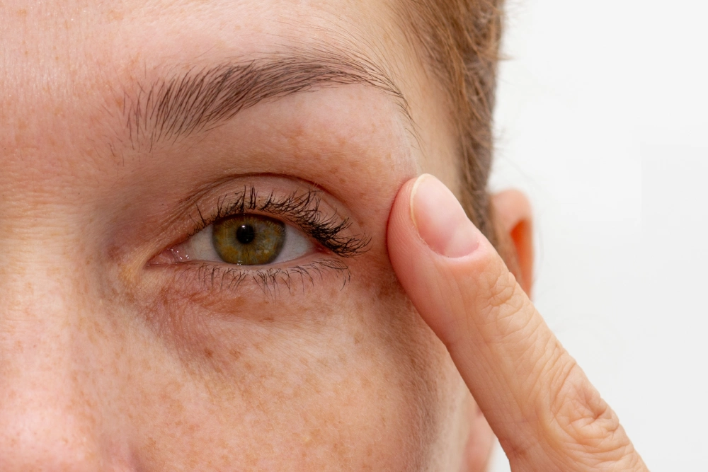 Get Eyelid Surgery in Casper, WY | New Beautiful You